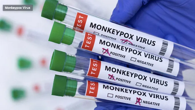 La viruela del mono se puede contener: expertos instan a pruebas y vacunación