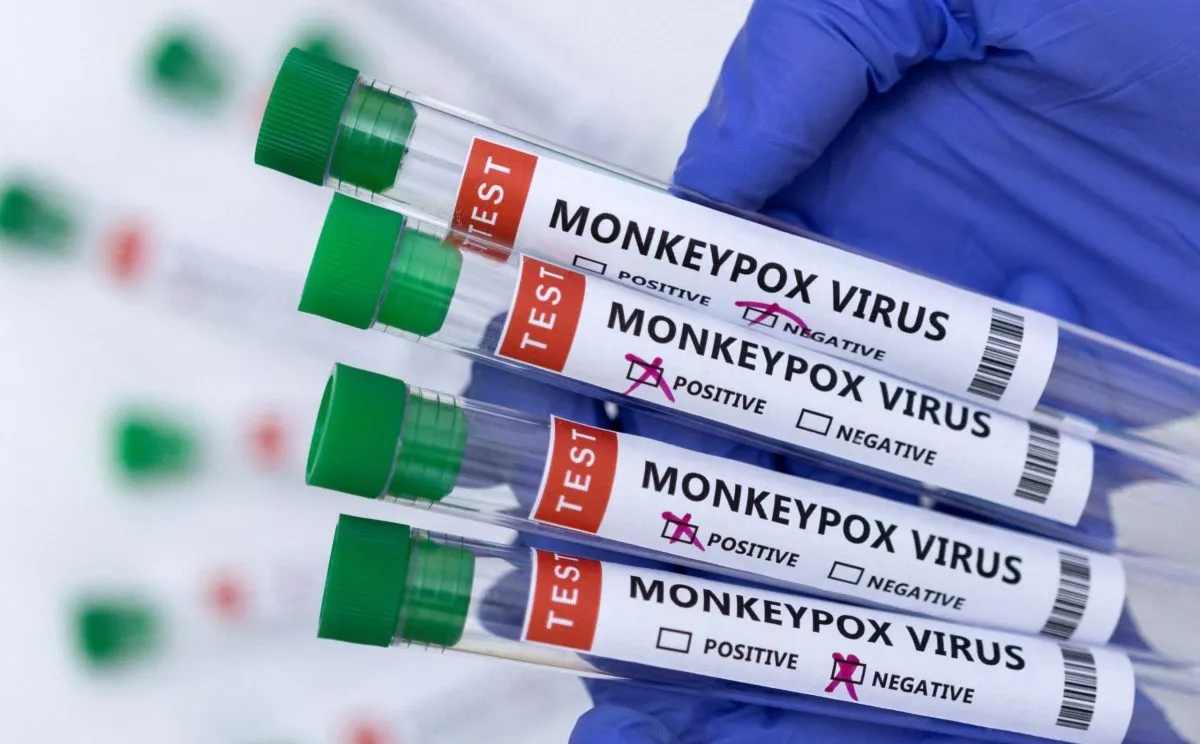 Los tubos de ensayo etiquetados como "virus de la viruela del mono positivo y negativo" se ven en esta ilustración tomada el