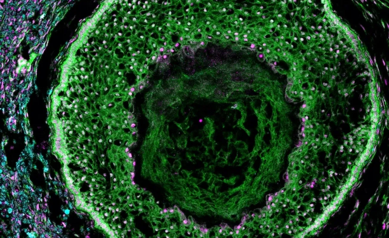 Científicos de Harvard podrían cultivar ovarios humanos para desarrollar nuevos tratamientos contra el cáncer y la infertilid